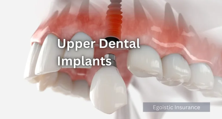 upper dental implants