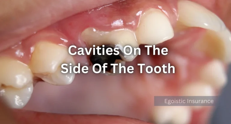 cavities on the side of the tooth