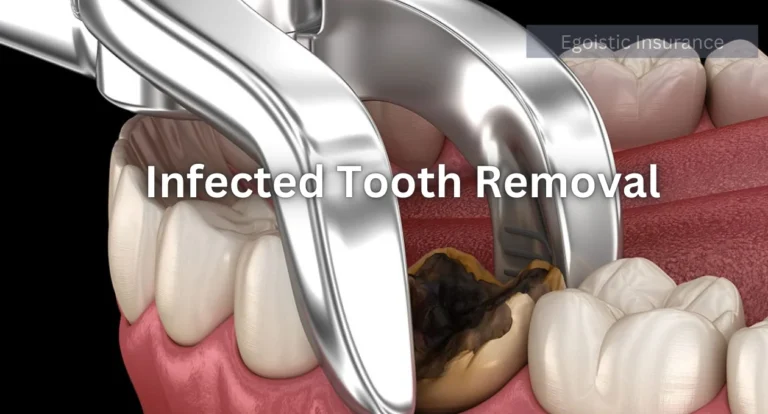 infected tooth removal