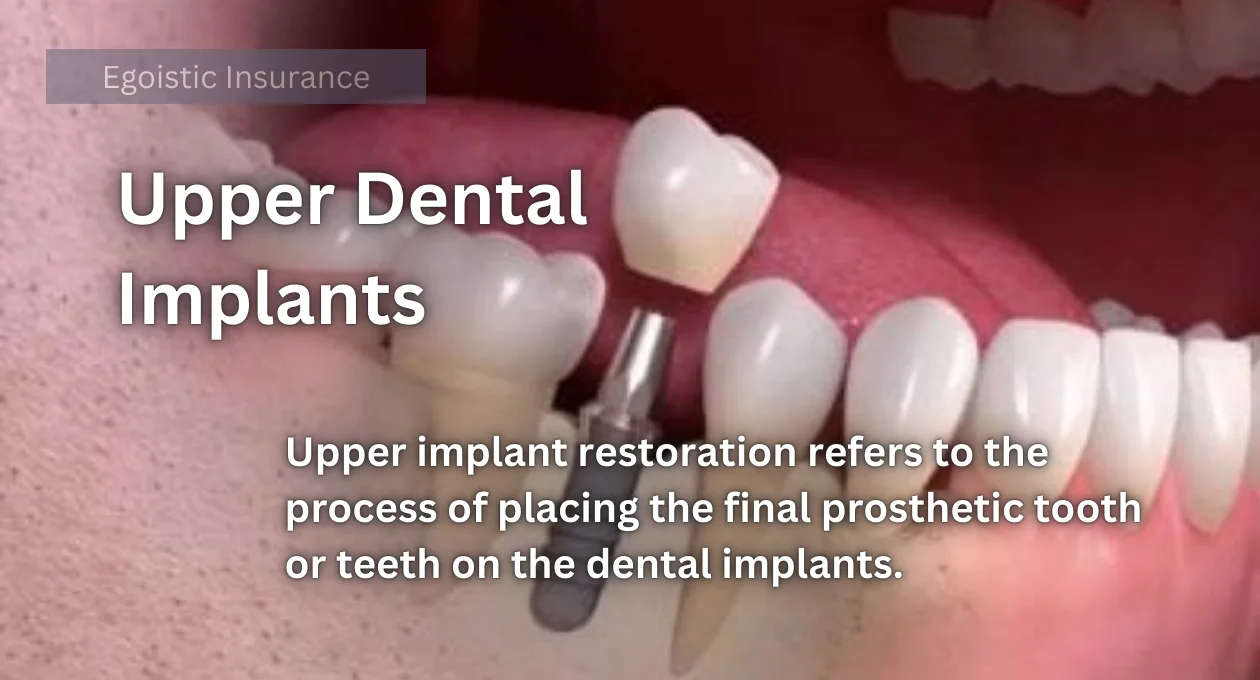 upper dental implants